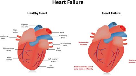 mild global hypokinesis of the left ventricle